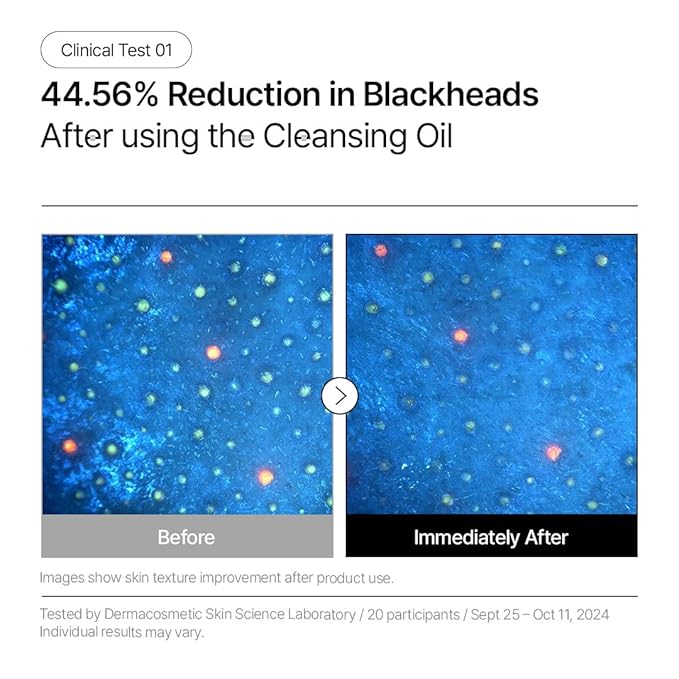 Parnell Aha Omija Ceramic Cleansing Oil 200ml / 6.76 fl.oz | blackhead melting, korean facial cleanser, korean skincare-FemmiqueWomen