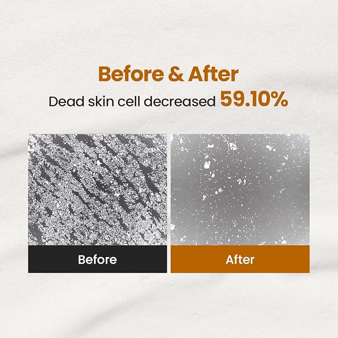 Enzyme Cleansing Powder – 40g (1.41 oz) – Purifies Pores, Removes Blackheads & Whiteheads, With Papain Enzyme for Smooth & Clear Skin | Low pH, Non-Irritating, For Sensitive Skin-FemmiqueWomen