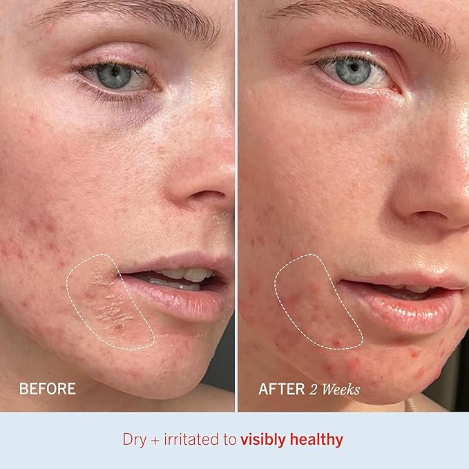 First Aid Beauty - Ultra Repair Cream, Intense Hydration Whipped Colloidal Oatmeal, Clinically Proven to Strengthen Skin Barrier & Help Relieve Eczema, Face & Body Moisturizer, 14oz Peppermint Twist-FemmiqueWomen