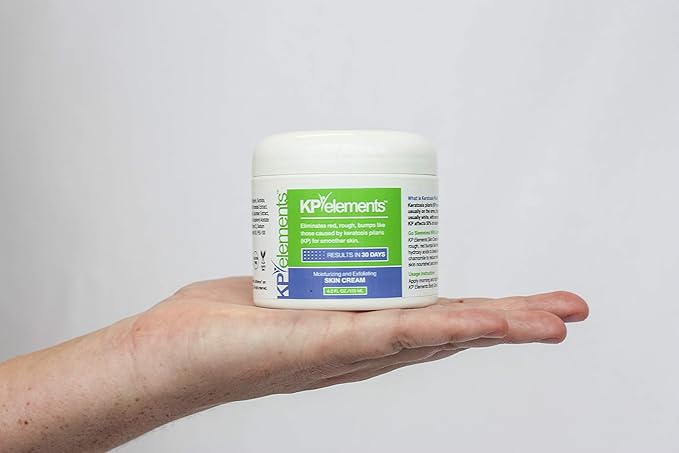 KP Elements Keratosis Pilaris Lotion (4 fl oz) - Natural Keratosis Pilaris Treatment, Moisturizing & Exfoliating AHA Lotion for KP, Vegan, Made in USA-FemmiqueWomen