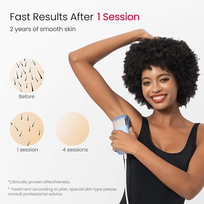 IPL Laser Hair Removal for Women and Men, 2 Lights, 2℃, 16.6 cm² Sapphire Ice Cooling for Sensitive Skin, 4-Pulse Mode for Ingrown Hair, Bikini, Face, Body Permanent Epilator Home Hair Removal Device-FemmiqueWomen