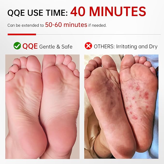 3 Pack Foot Peeling Mask, Hydrating Exfoliating Foot Mask for Dry Cracked Feet, Callus Remover & Cracked Heel Repair & Foot Care-FemmiqueWomen