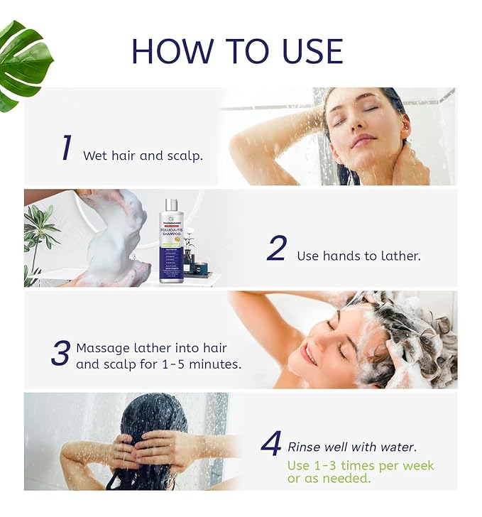 Anti-Fungal Shampoo for Folliculitis, Seborrheic Dermatitis, Scalp Psoriasis - Relieves Itchy & Dry Scalp-FemmiqueWomen