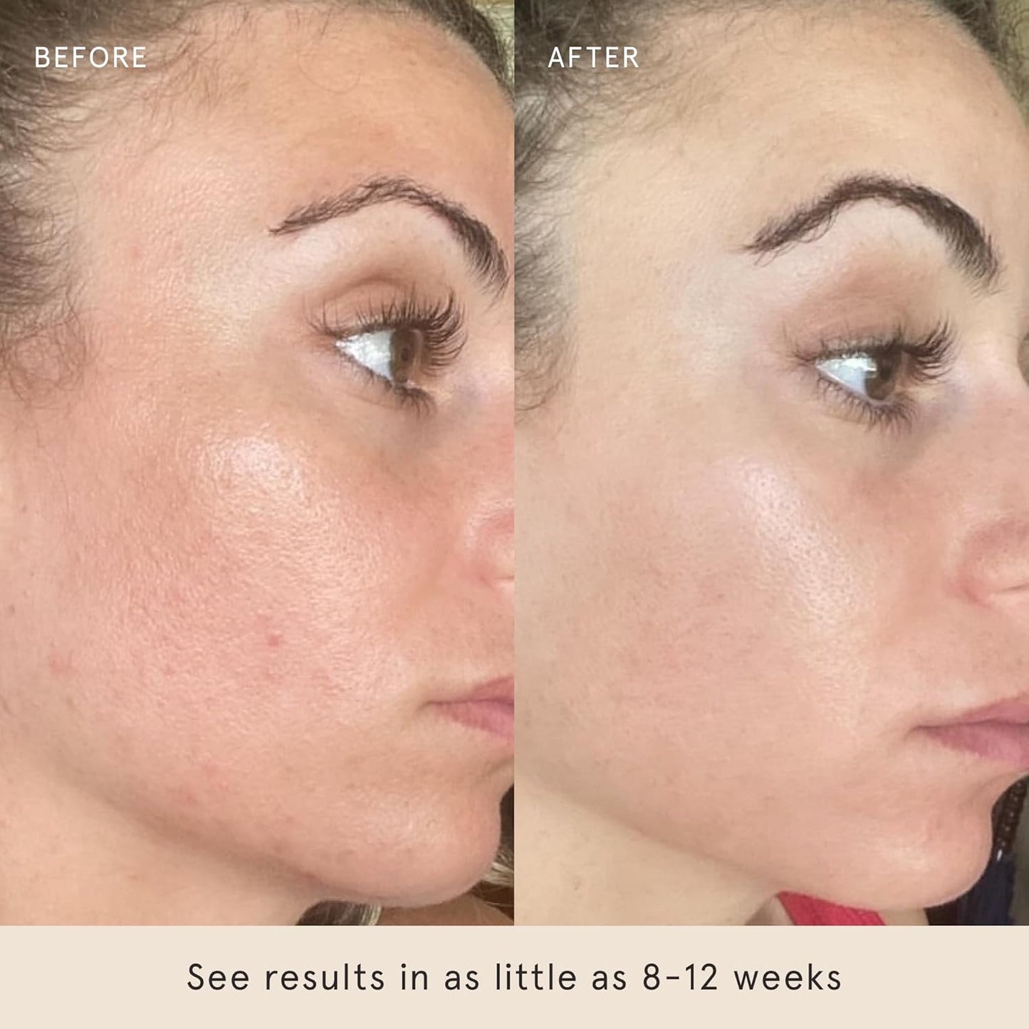 Barefaced Toning Pads (60 count) - Exfoliating Face Pads with 2% Glycolic Acid & Salicylic Acid - Brightens & Cleanses Skin, Clears Pores, Reduces Fine Lines & Wrinkles-FemmiqueWomen