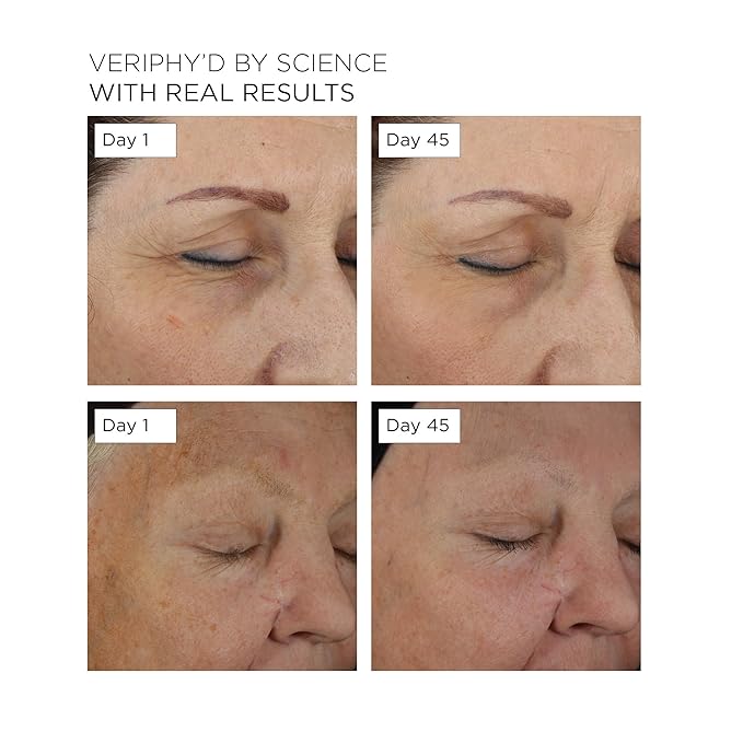 20/20 Eye Cream for Dark Circles and Puffiness | Vegan | Clean | Natural | Cruelty-free | Anti-Aging | Eye Cream for Wrinkles | Women in STEM-FemmiqueWomen