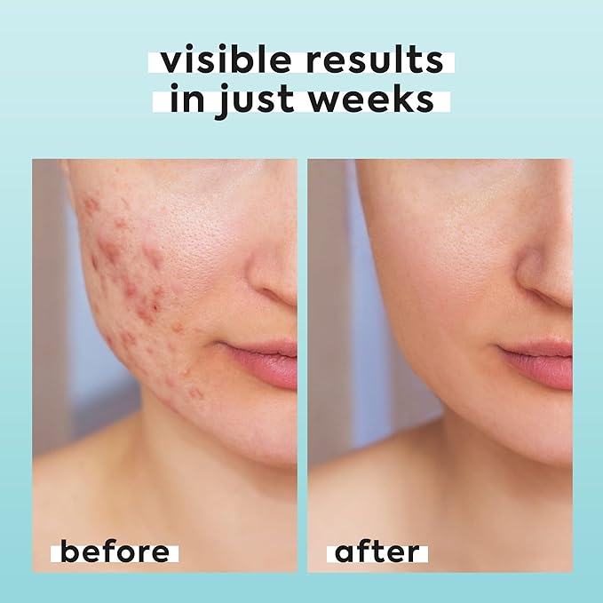 Hypochlorous Acid Spray for Face & Body - Helps Reduce Redness and Breakouts - Travel Size Hypochlorous Spray, Multi-Purpose Topical Facial Skin Repair, pH-Balancing Toner - TSA, Livaclean-FemmiqueWomen