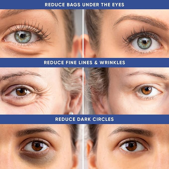 Instant Puffy Eye & Lift Treatment – Removes Under Eye Bags & Puffiness. Eliminate Dark Circles & Wrinkles. Naturally Ageless Hydrating Cream. Disappears Before Your Eyes Within Minutes.-FemmiqueWomen