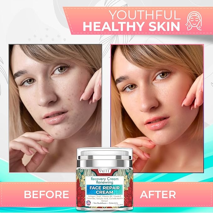 VAITE Face Moisturizer Remedy Skin Repair Cream with Snail, Salicylic Acid, Vitamin B5, Vitamin E, Collagen, and Ceramides for Men and Women Anti-aging Anti-wrinkle Made in USA Night and Day-FemmiqueWomen