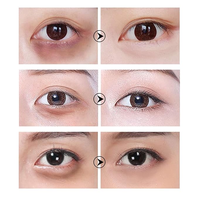 30 Pairs Hyaluronic Acid Collagen Eye Mask,Moisturizing Brightening Eye Mask, Eyes Treatment for Reducing Dark Circles, Lighten Wrinkles Anti-Aging, Fine Lines Eye Bags Puffiness for Women Men-FemmiqueWomen