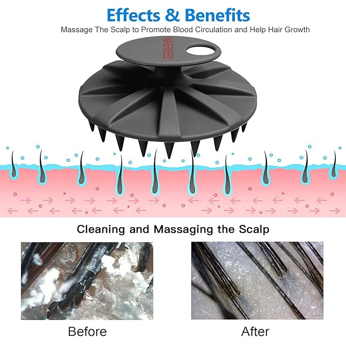 INNERNEED Scalp Massager Shampoo Brush, Wet & Dry Manual Scalp Care Head Scrubber Hair Washing, Soft Silicone Bristles, for Hair Growth, Dandruff Removal (Black+Pink)-FemmiqueWomen