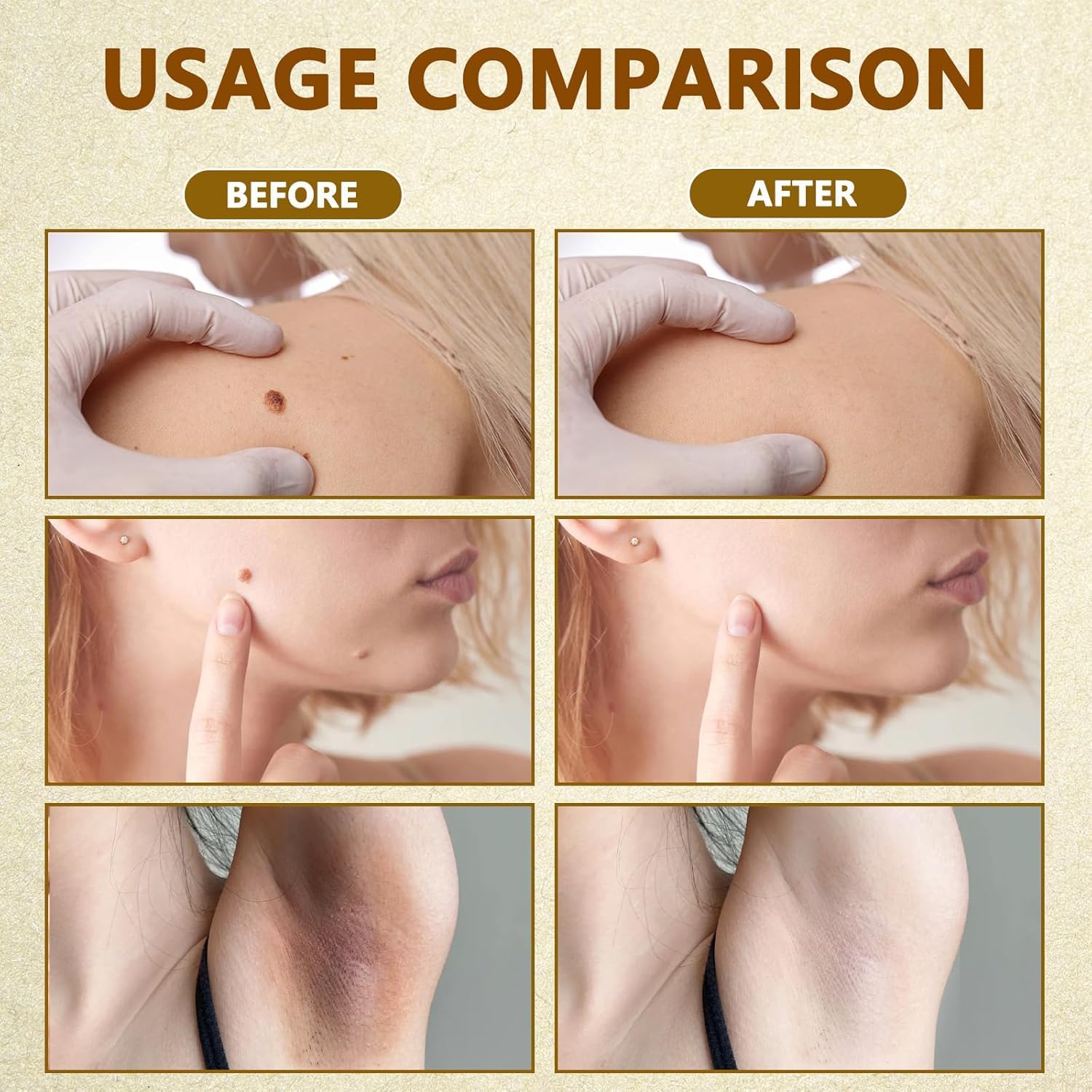 Bee Venom Skin Restoration Cream, Bee Venom Skin Treatment Cream, Repair and Wrinkle Reducing Comprehensive Moisturizer for All skin Types 2PC-FemmiqueWomen