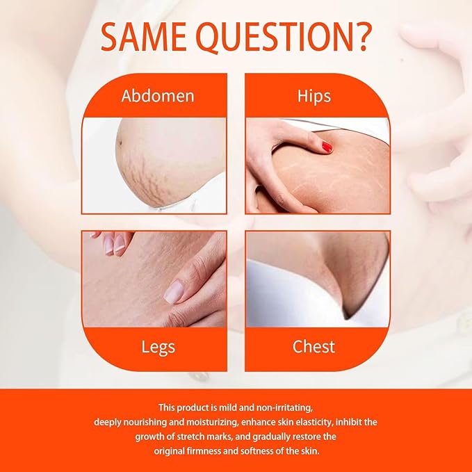 Stretch Mark Pregnancy Oil, Natural Oil Skincare Body Oil Serum for Scars and Stretch Marks, Face with Vitamin E & A for Sensitive Dry Skin and Body Moisturizer-FemmiqueWomen