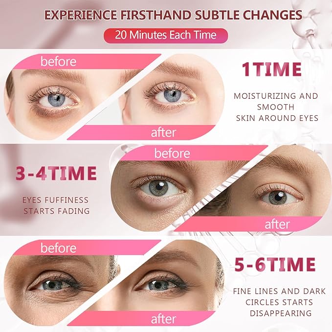 2 Packs 60 Pcs Under Eye Patches, 24K Gold+Pink, 30 Pairs Women Undereye Mask for Puffy Eyes Dark Circles Treatment, Men Collagen Gel Pads Hydrating for Eye Bags Puffiness Wrinkle, Beauty Skin Care-FemmiqueWomen