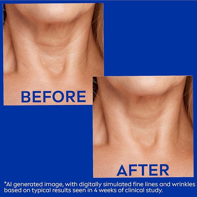 NIVEA Skin Firming & Anti Wrinkle Neck & Chest Cream with Coenzyme Q10, Creatine and Provitamin B5, Skin Firming Cream Reduces the Look of Fine Lines and Wrinkles, 6.7 Oz Tube-FemmiqueWomen