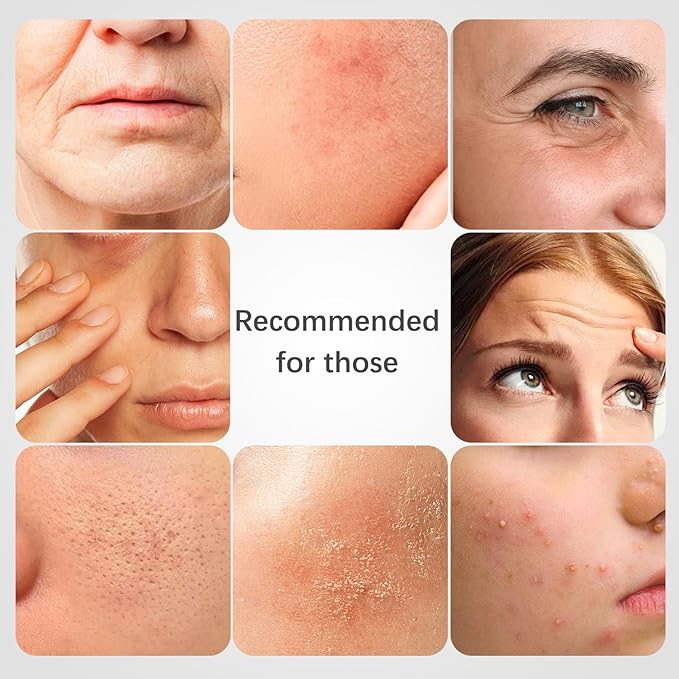 ISTON 4-in-1 Bio-Collagen Real Deep Mask Set -Plump Sagging Skin,Deep Hydration,Soothe & Repair,Nourish & Firm, Overnight Hydrogel Mask for All Skin Type-FemmiqueWomen