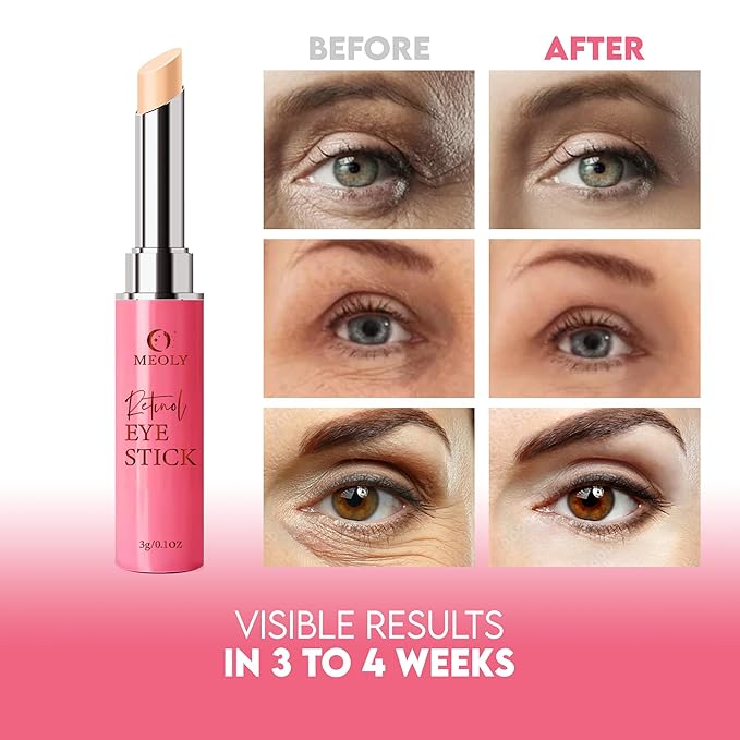 Instant Eye Bag Remover, Retinol Eye Cream for Dark Circles, Under Eye Brightener Stick, Under Eye Cream Anti Aging, Eye Cream for Wrinkles, Brightening Eye Cream for Puffiness and Bags-FemmiqueWomen