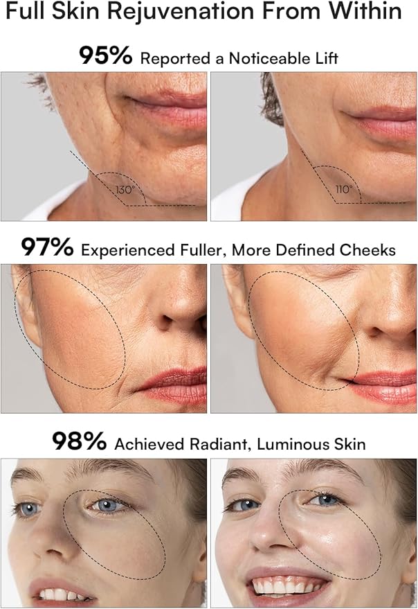 INIA Micro-Current Facial Device, 3-in-1 Facial Massager Red Light Therapy for Face and Neck True Beauty Glow Device Effective for Wrinkle and Puffiness-FemmiqueWomen