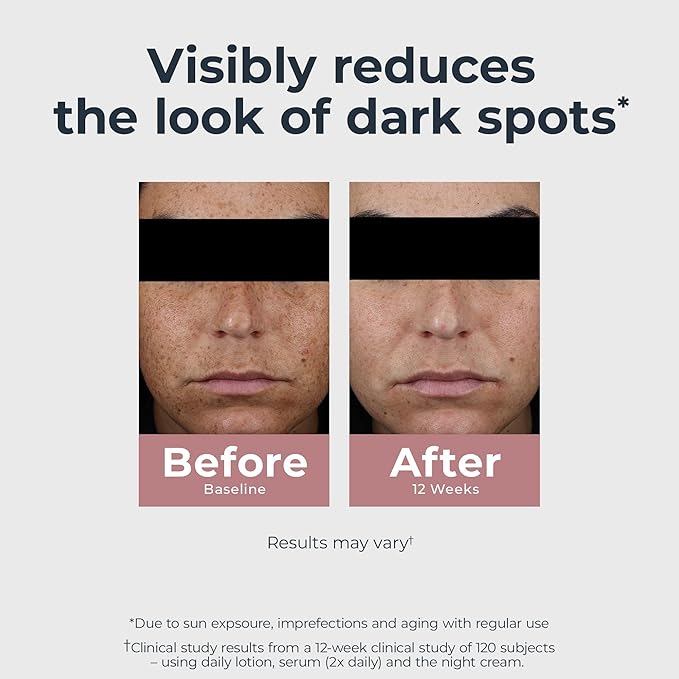 Eucerin Radiant Tone Night Cream, Dark Spot Corrector with Thiamidol, Night Moisturizer for Face Helps Visibly Reduce the Look of Persistent Dark Spots, All Skin Types, 1.7 Oz Bottle-FemmiqueWomen