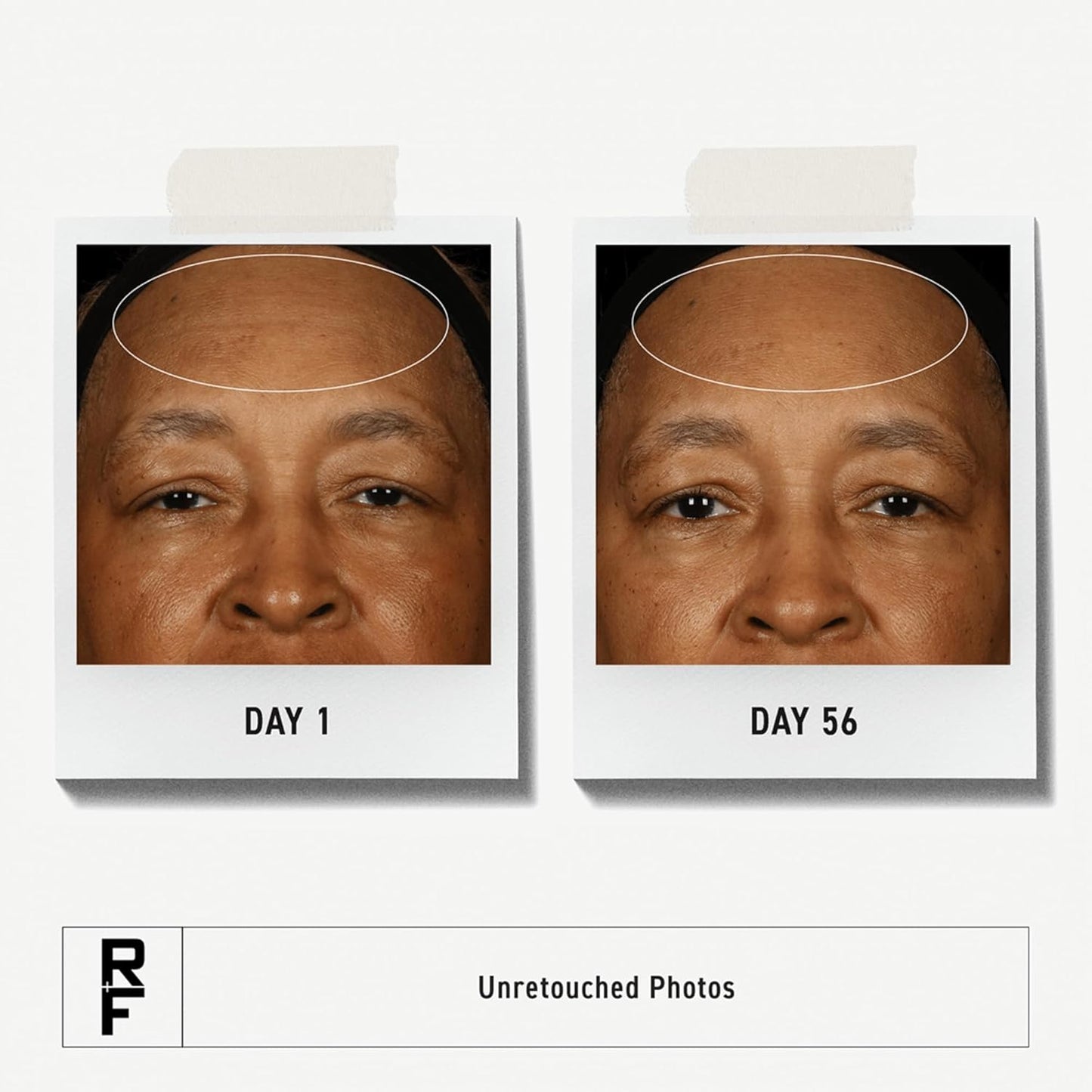 Rodan + Fields Redefine Pore Minimizing Toner | 4.2 fl oz | Deep Exfoliating Cleanser | Visibly Reduces Blackheads | Formulated with Fruit Acids-FemmiqueWomen