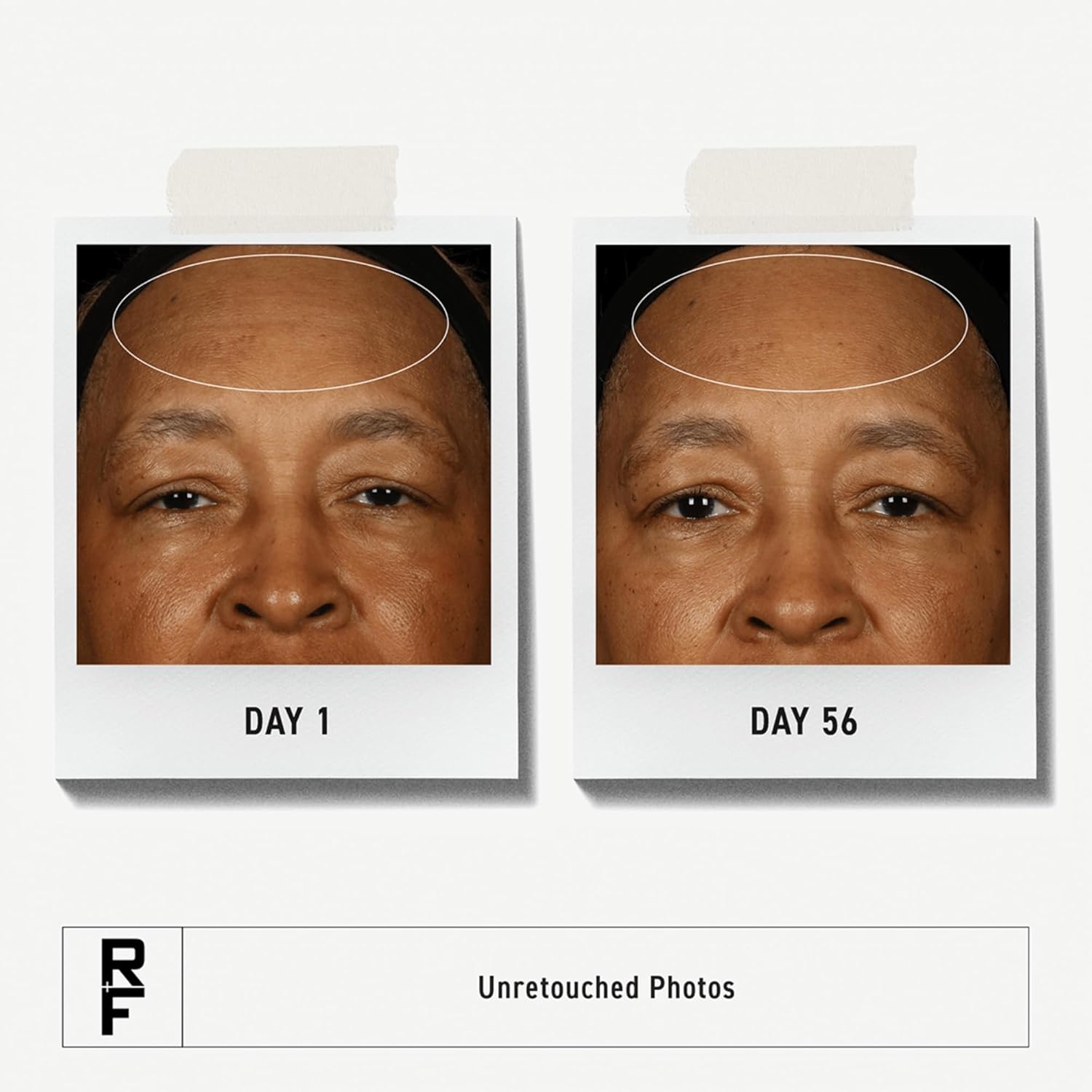 Rodan + Fields Redefine Pore Minimizing Toner | 4.2 fl oz | Deep Exfoliating Cleanser | Visibly Reduces Blackheads | Formulated with Fruit Acids-FemmiqueWomen