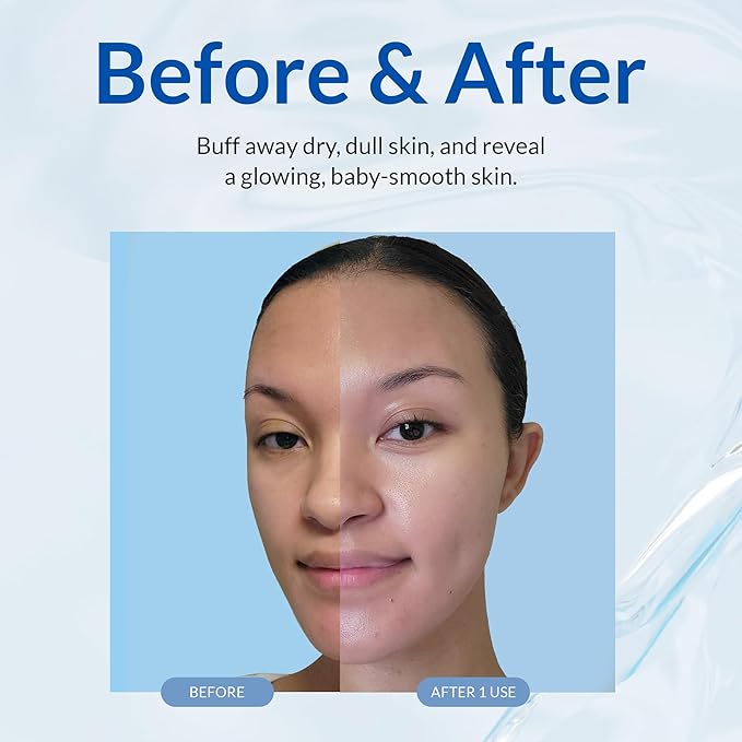 Cure by Toyo | Aqua Gel Gentle Exfoliator | Clear and Softer Skin | Non-Abrasive Face and Body Cleanser | Sensitive Skin | 3 Pack-FemmiqueWomen