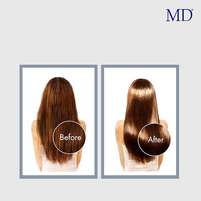 MD Revitalizing Shampoo for Men & Women – Sulphate-Free Hair Thinning Shampoo with Aloe Vera, Chamomile – Hair Loss, Regrowth Anti Thinning Shampoo for All Hair Types-FemmiqueWomen