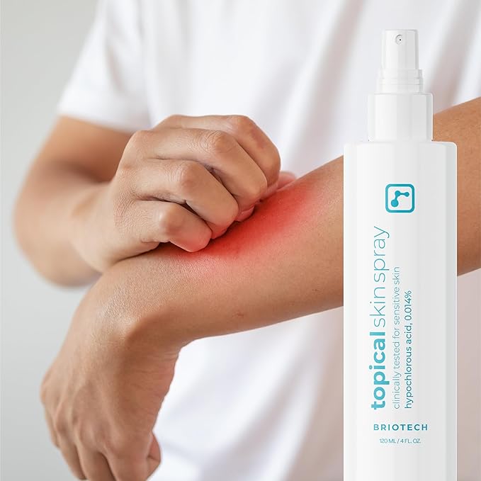 BRIOTECH Topical Skin Spray, Hypochlorous Acid Spray for Sensitive Skin, HOCl Facial Mist, Full Body Support Against Irritation, Calm Redness, Soothe Foot & Scalp, 2 oz Travel Size-FemmiqueWomen