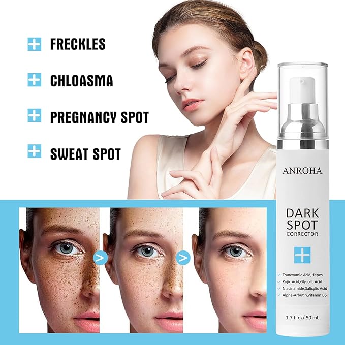 Face and Body Serum Promotes Anti-Aging Effect for Women and Men with Niacinamide,Kojic Acid & Salicyic Acid 50ml (Pack of 2)-FemmiqueWomen