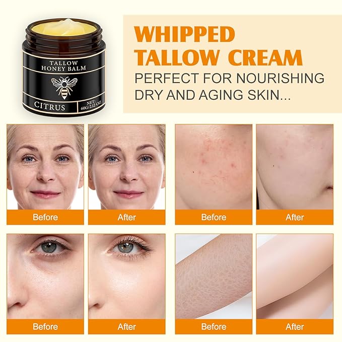 Tallow Honey Balm for Face Organic，Crema Cebo De Res Original，Handmade Tallow and Honey Balm for Face,Body，Sebo De Res Para La Cara，Based Supplies Tallow and Ho ney Bal m for Smooth Skin (2 Bottle)-FemmiqueWomen