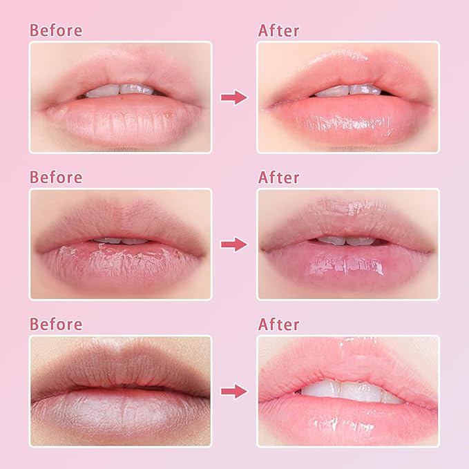 3 Pcs Bee Lip Balm Honey Pot, Cherry Watermelon Apple Lip Mask Overnight, Moisturizing Lip Sleeping Mask, Hydrate Repair Prevent Dry Cracked Lip Exfoliator Lip Care (Cherry+Watermelon+Apple Lime)-FemmiqueWomen