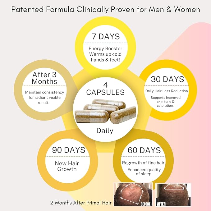 100% Natural Growth Treatment, Reduces Hair Loss, US Patented Formula Proven Effective for Men & Women, 100% Vegan Ingredients, Non-GMO, 30-Day Supply-FemmiqueWomen