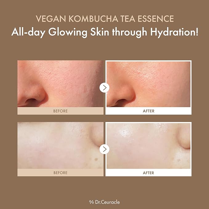 Dr.Ceuracle Vegan Kombucha Tea Essence - Hydrating Milky Toner with Kombucha Tea Extract, Centella Asiatica, Ceramide, Korean Skincare (150 ml / 5.07 fl. oz.)-FemmiqueWomen