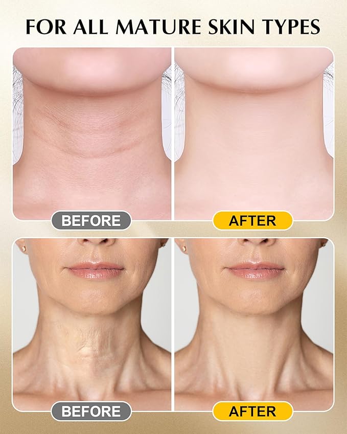 Neck Firming Cream with 3% Retinol - Hyaluronic Acid, Anti-Wrinkle Treatment, Skin Tightening Cream for Face, Neck, Chest & Décolleté-FemmiqueWomen