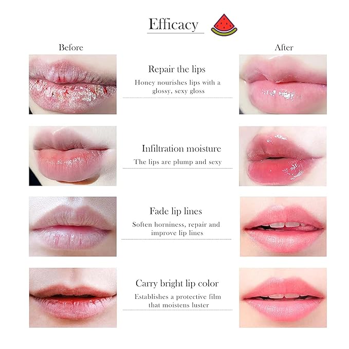 1 PCS Bee Lip Balm Honey Pot, Moisturizing Watermelon Sleeping Lip Balm Lip Mask Overnight, Hydrate Lip Repair Prevent Dry and Cracked Lip Care, Nourishes the Lip Skin, Reduces Lip Lines-FemmiqueWomen
