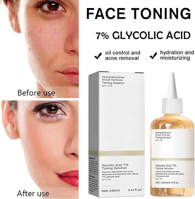 Glycolic Acid Toning Solution, Glycolic Acid 7% Toner, Glycolic Sour 7% Toning, KeepThe Skin Moist, Exfoliating Serum for Face, Facial Exfoliation Astringe Pores (240ML/8.0 Fl Oz)-FemmiqueWomen