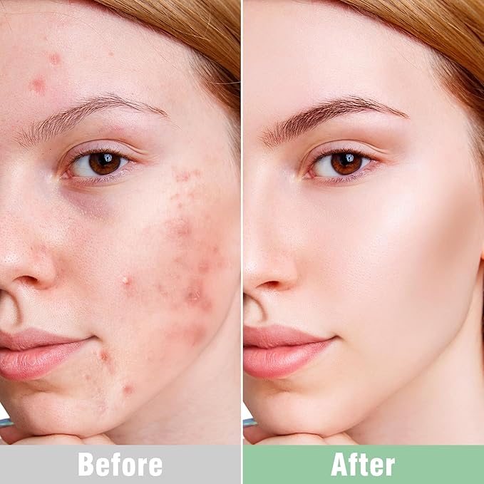 ISTON Overnight Hydrogel Face Mask for All Skin-FemmiqueWomen