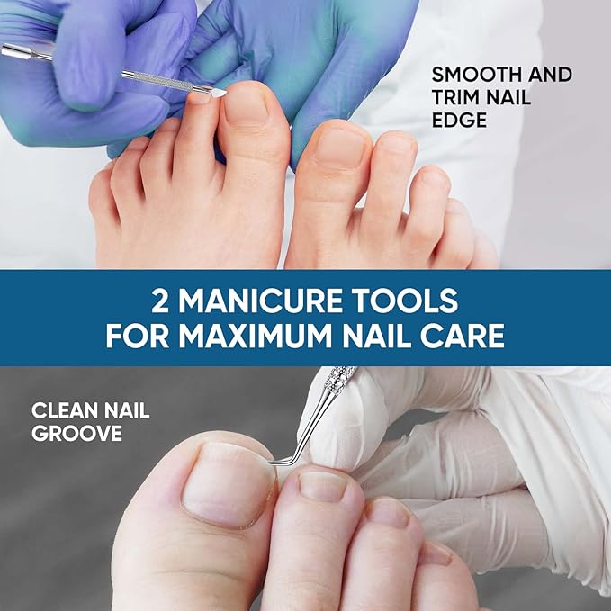 Ingrown Toenail Treatment, 60Pcs Ingrown Toenail Corrector Strips, Ingrown Toenail Removal Kit with File and Lifter, 60Pcs-FemmiqueWomen