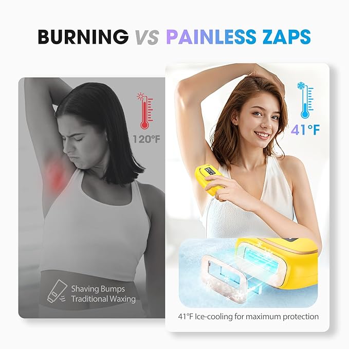 IPL Laser Hair Removal Device for Women & Men - Home 45°F Ice-Cooling Contact for Painless & Long-Lasting Results, 86% Hair Reduction in 3 Weeks for Full Body & Bikini Line, Light Yellow-FemmiqueWomen