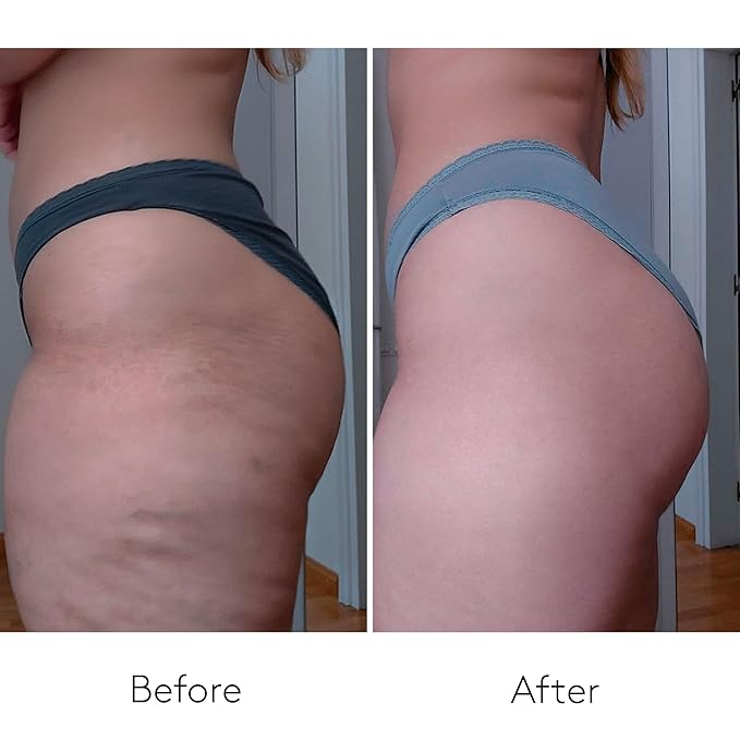 COCUNAT - Body Power - Anti Cellulite Cream - Body Firming Cream - Cellulite Remover - Toned Skin - With Caffeine and Hyaluronic Acid - 150 ml + 125 ml-FemmiqueWomen