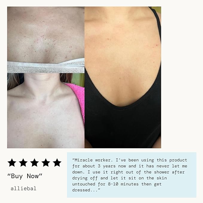 Pacifica Bacne Acne Cleanser Spray - Bacne Warrior - Body Spray for Acne Treatment - w/ 2% Salicylic Acid Niacinamide & Aloe - for Body, Chest & Back Acne for Teens & Adults Vegan Dermatologist Tested-FemmiqueWomen