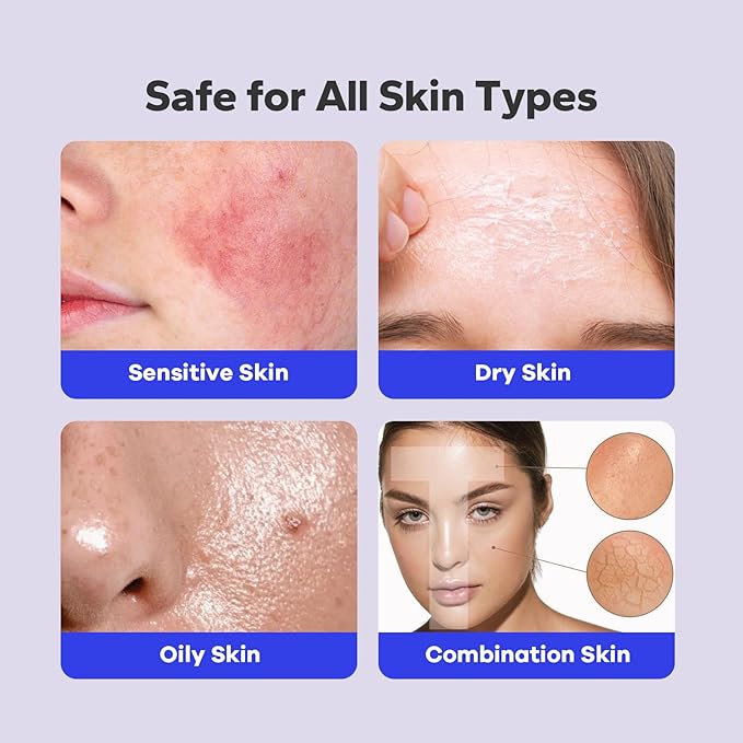 Salicylic Acid Spray (5.07 Fl Oz), 2% Salicylic Acid Body Spray, Body Acne Treatment for Bacne, Blackheads & Blemishes, Back & Chest Acne Spray for Face & Body, 360° Mist for All Skin Types-FemmiqueWomen