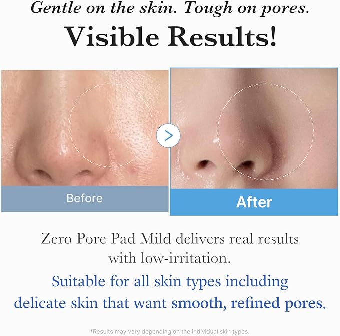 Medicube Zero Pore Pads Mild 2.0 (70 units) - Gentle Calming Toner Pads for Exfoliation, Minimizing Pores, and Blackhead Removal with PHA - Ideal for All Skin Types - Korean Skin Care-FemmiqueWomen
