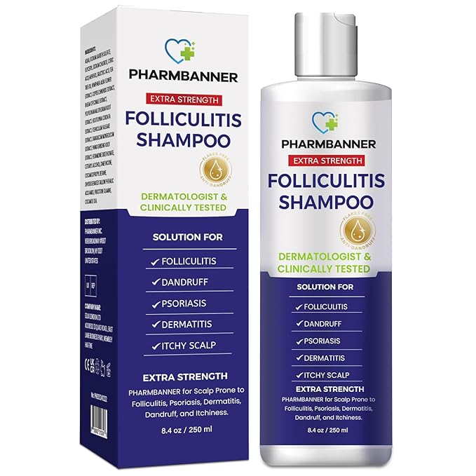 Anti-Fungal Shampoo for Folliculitis, Seborrheic Dermatitis, Scalp Psoriasis - Relieves Itchy & Dry Scalp-FemmiqueWomen