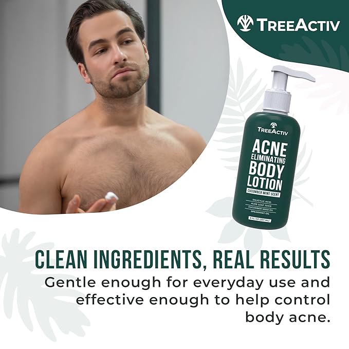 TreeActiv Acne Eliminating Body Lotion 8 fl oz | Clears Body, Back, Butt and Shoulder Acne | Anti-Acne Moisturizer | Prevents Future Breakouts | Cucumber Mint Scent-FemmiqueWomen