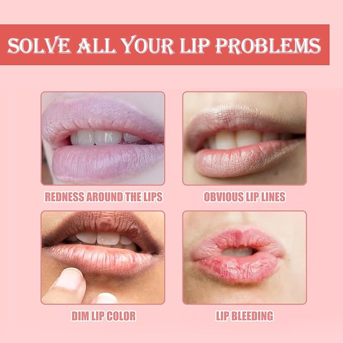 3 PCS Bee Lip Balm Honey Pot, Exfoliating Honey Strawberry Watermelon Lip Mask Overnight with Built-In Brush, Hydrating Prevention Dry and Crack Lip Scrubs Exfoliator Lip Wrinkle Care-FemmiqueWomen