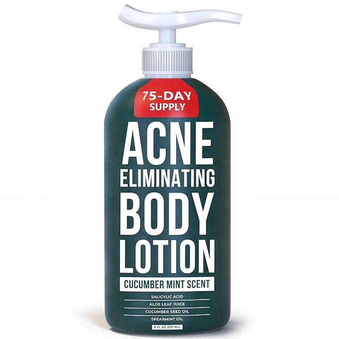 TreeActiv Acne Eliminating Body Lotion 8 fl oz | Clears Body, Back, Butt and Shoulder Acne | Anti-Acne Moisturizer | Prevents Future Breakouts | Cucumber Mint Scent-FemmiqueWomen