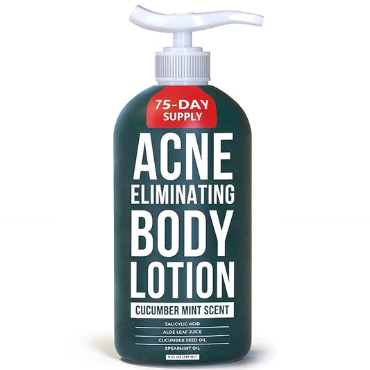 TreeActiv Acne Eliminating Body Lotion 8 fl oz | Clears Body, Back, Butt and Shoulder Acne | Anti-Acne Moisturizer | Prevents Future Breakouts | Cucumber Mint Scent-FemmiqueWomen