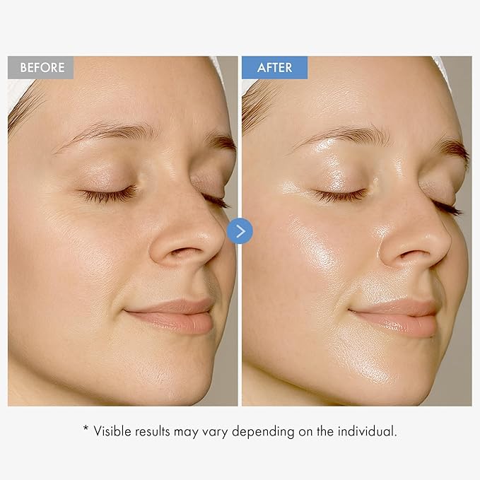 Hyaluronic Acid 9 Cream, Vitamin B5, Collagen, Niacinamide, Centella Asiatica Extract, Long-lasting Hydration, Daily Moisturizer Face Cream, Korean Skin Care, 50ml, 1.69 fl.oz.-FemmiqueWomen