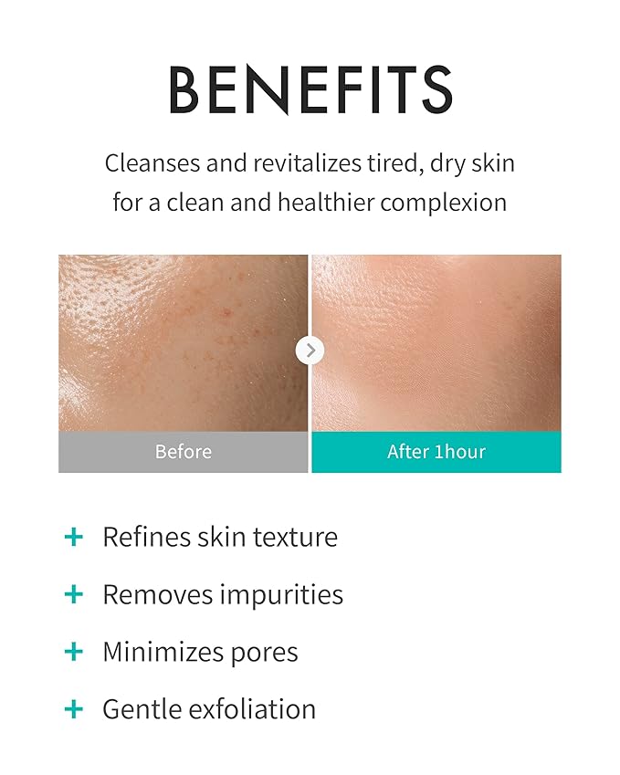 REJURAN® Refining Foam Cleanser, c-PDRN® – Hydrating & Gentle for Smoother, Clearer Skin, Minimizes Pores & Balances with Hyaluronic Acid & Tanin Complex, Korean Skin Care (4.05 fl oz)-FemmiqueWomen