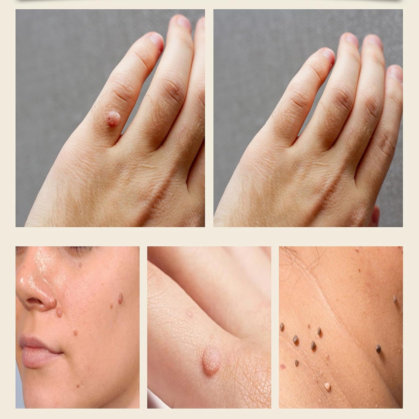 Bee Venom Skin Treatment Cream, Bee Venom Repair Cream, Suitable for All Skin Types-FemmiqueWomen